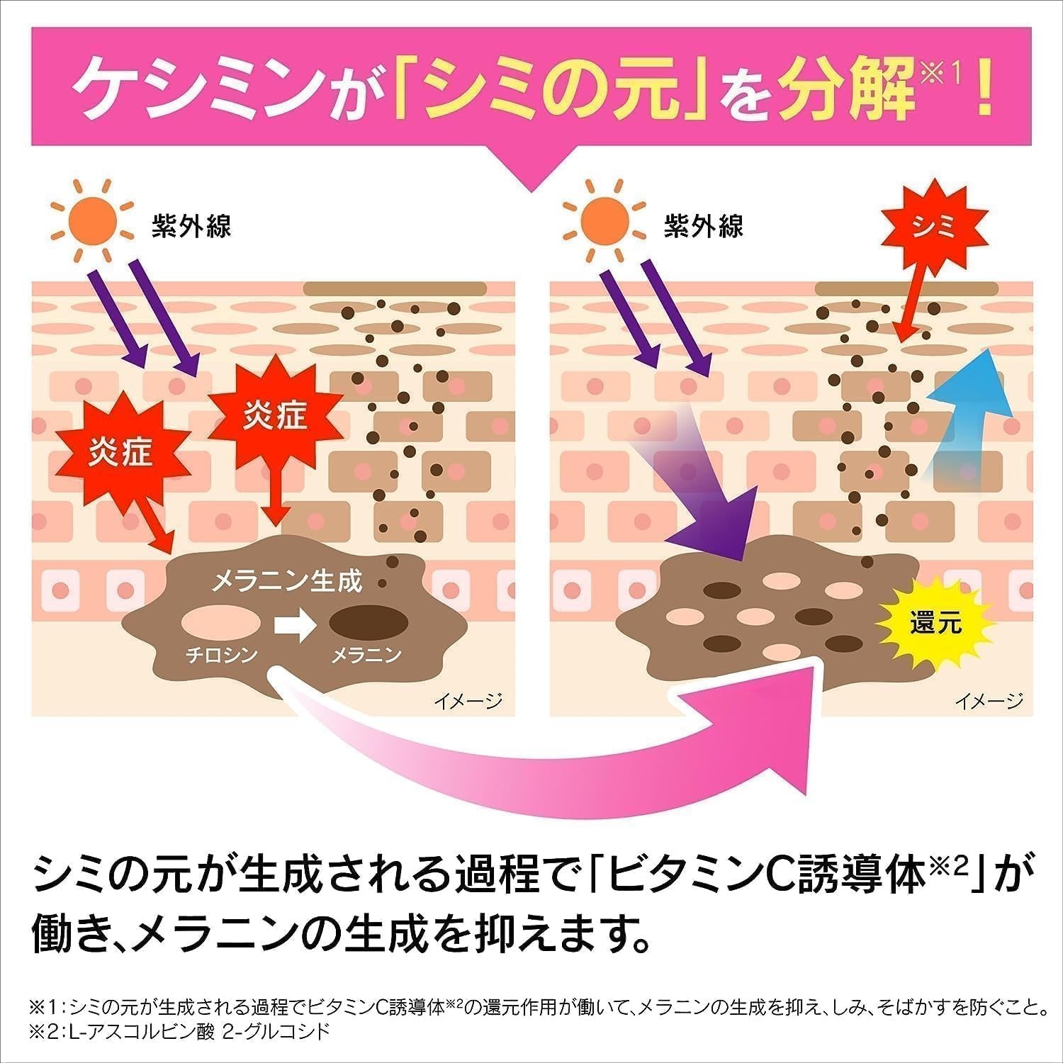 Keshimin Cream 30g age spots and freckles Vitamin C E Nightpack from Japan New